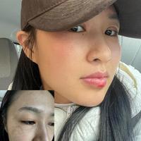 黛珂曲酸精华见效慢？真相是90%的人没给够皮肤代谢时间