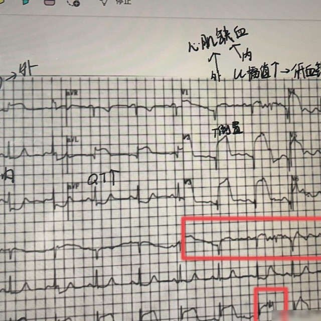180Hz电视真香？先问自己每周看几小时球赛打几把游戏