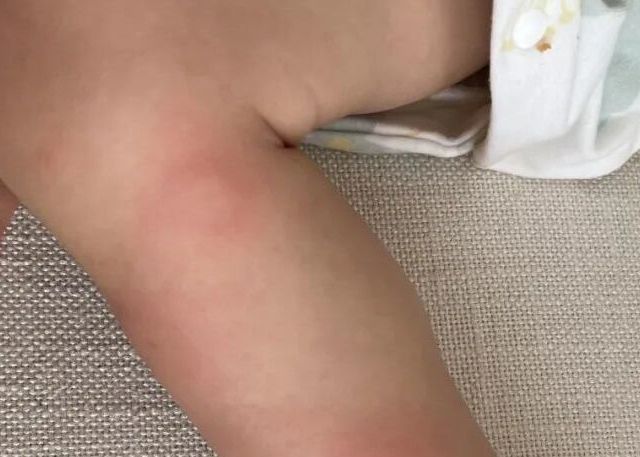 被年轻人的“防蚊大法”惊艳到！思路很绝，蚊子根本咬不到