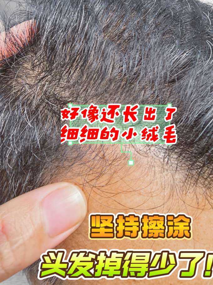 日常用药