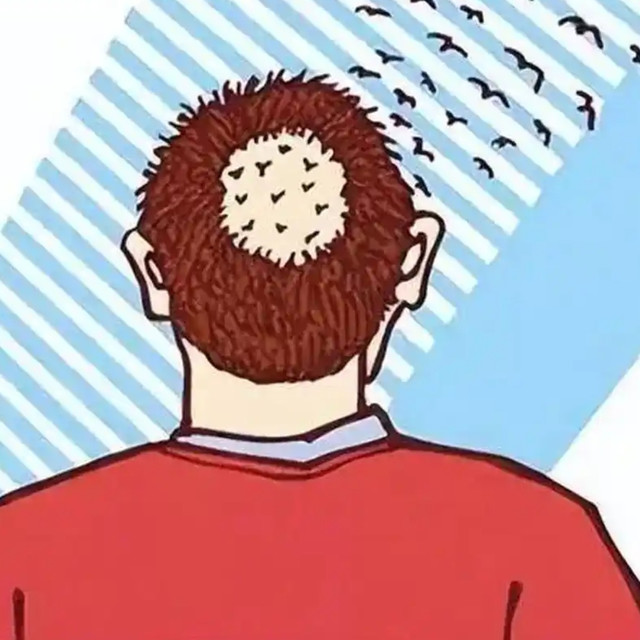斑秃怎么调理_黑奥秘四大专利成分促进毛囊健康