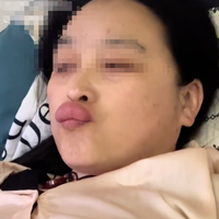 “吸娃”翻车！姥姥亲吻婴儿脚丫后感染！婴儿为什么会有脚气？