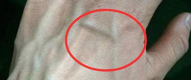 手臂青筋暴起vs看不到青筋，到底谁更健康？多数人全搞错了