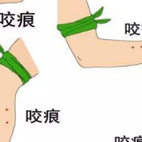 夏季野外谨防毒蛇出没，遇见毒蛇这样自救保命，关键时刻能救命