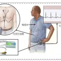 【静享科普】24小时动态心电图检查全攻略！