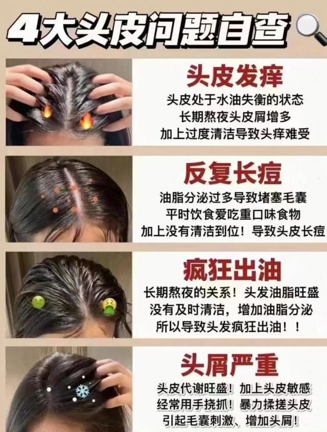 去屑用什么牌子的洗发水效果好？2026去屑止痒十大洗发水实测，公认去屑好用的洗发水推荐