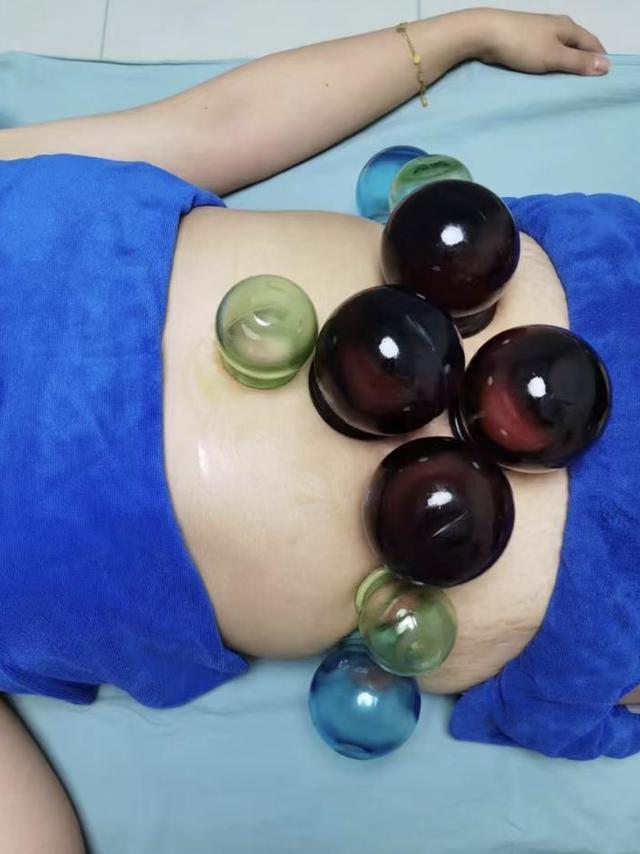脂肪肝、内脏脂肪超标，我在秀域做古方减肥，轻松养回健康体态