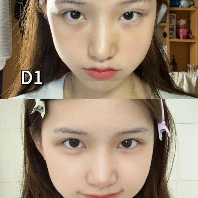 理肤泉vs修丽可B5精华：谁才是敏感肌的真命天子？