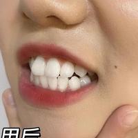 冷酸灵vs舒适达：抗敏牙膏怎么选才不踩雷？