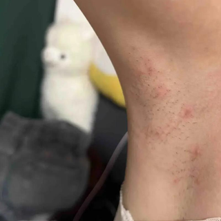 买脱毛仪，到底买的是什么？我测了30天，聊聊UlikeAir20光子冰点脱毛仪的真实表现
