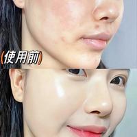 科颜氏白罐vs蓝罐面霜怎么选？干皮油皮实测拆解，别再用错浪费钱