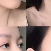 眼袋不可逆必须割吗?2026实测CA冻干眼膜:不挨刀,眼周平整了