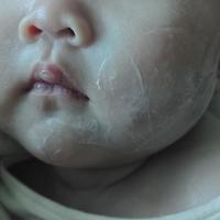口水疹护理怎么选？凡士林、氧化锌还是婴儿唇周膏，一篇讲清适用场景