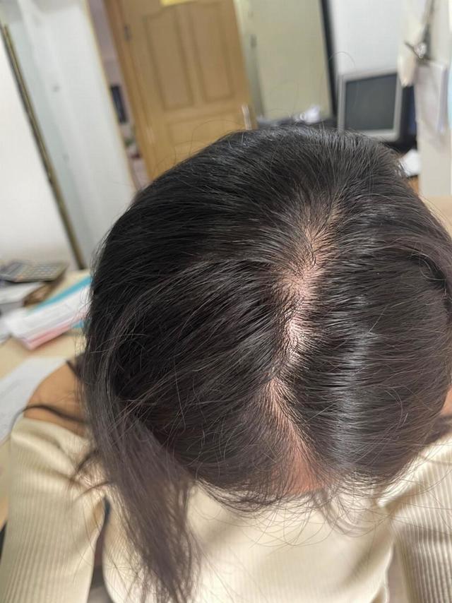 洗发水哪个牌子好用？2026高口碑防脱洗发水推荐，公认靠谱防脱名单