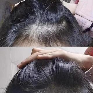 资生堂两款控油洗发水怎么选？抗衰养头皮vs即时舒缓，一篇说清区别