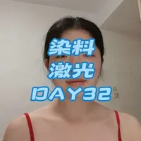 染料激光去红血丝术后恢复实录：干性与湿性愈合对比及术前护理指南