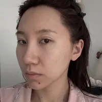 种发际线后一定要知道的10点……