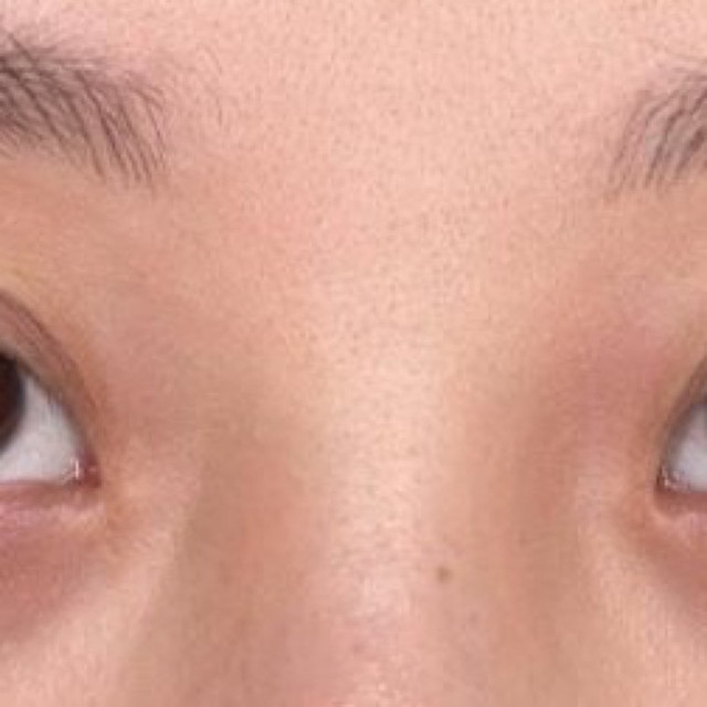 熬夜敏感肌黑眼圈怎么办？CA冻干眼膜，温和去黑眼圈首选