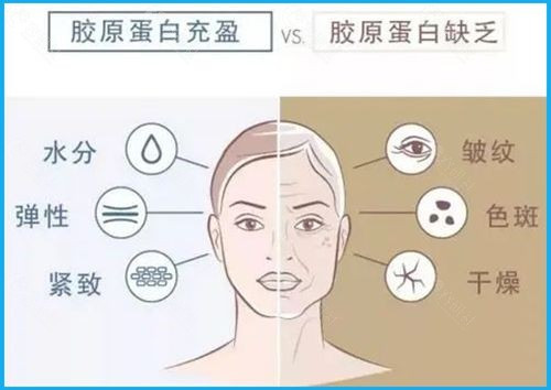 医美免税时代终结！2026年起涨价潮来袭，这样避坑最划算