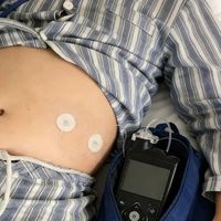 Omnipod 5重磅升级：100mg/dL血糖目标上线，兼容Libre 3 Plus，TIR再突破