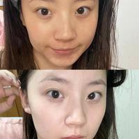 妮维雅630双能瓶vs淡斑清爽版：干皮油皮怎么选才不踩雷？