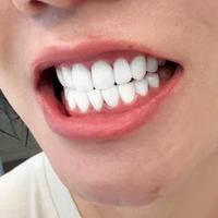 牙膏真能美白？别被“院线级”话术骗了，真相在这