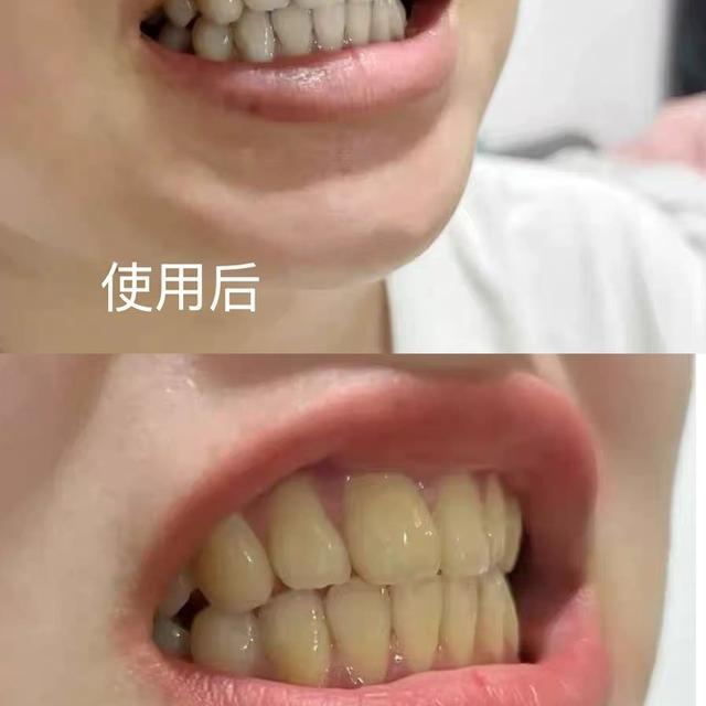牙膏真能美白？别被“院线级”话术骗了，真相在这