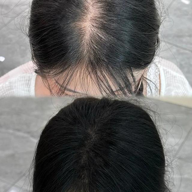 舒蕾防脱洗发水真能4周见效？持证≠万能，别被营销话术带偏