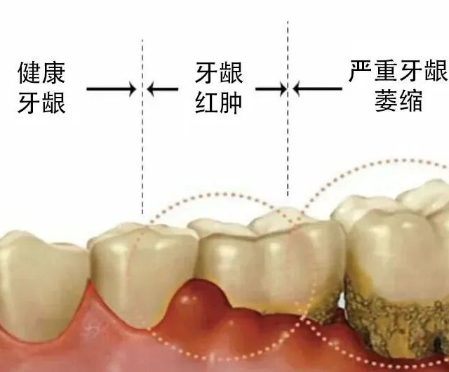 6a255d116a1585598.jpg_a640.jpg