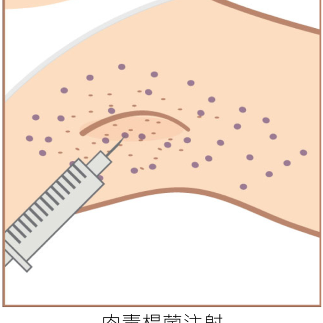 肉毒素注射能管多久？一文说清腋臭治疗效果与维持时间