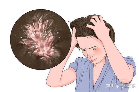 什么牌子防脱育发效果最好？十大公认防脱育发液哪个牌子最有效