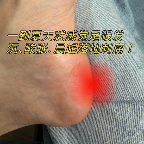 足底筋膜炎的人，夏天少折腾！