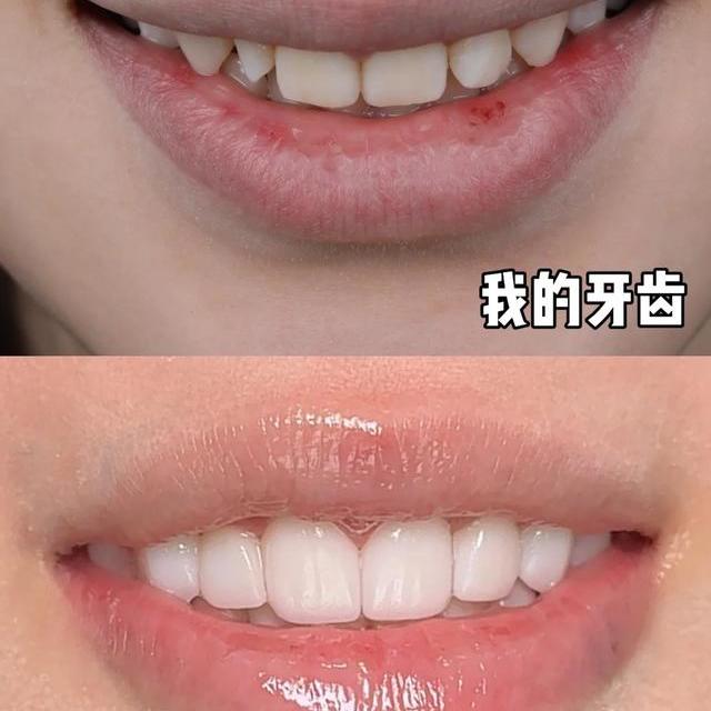 好来四款美白牙膏怎么选？3天亮白是真是假，一篇说清不踩雷