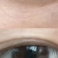 敏感肌眼膜实测:泛红刺痛党用CA冻干眼膜温和淡黑抗老
