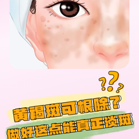 黄褐斑反复？别再乱用氨甲环酸了，医生说停药反弹其实是这事没做对