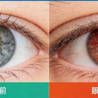 飞利浦vs妙界眼部按摩仪实测：谁才是熬夜党的真救星？