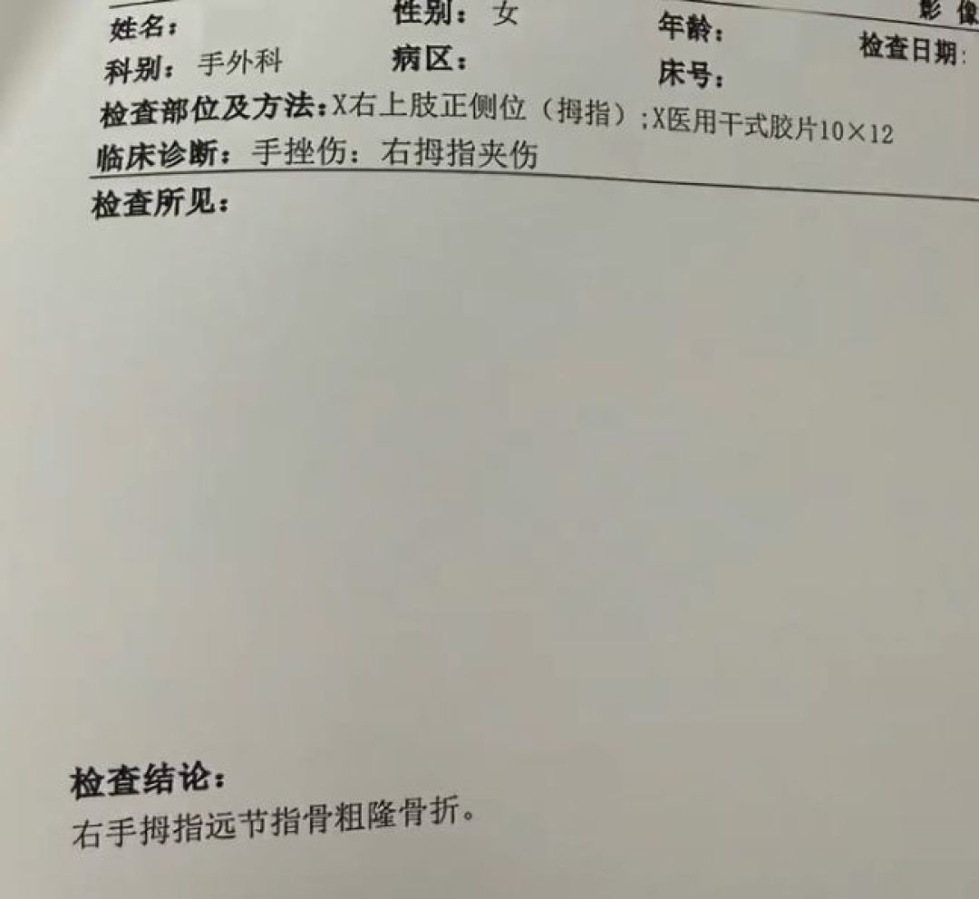 小米SU7电吸门夹断一根手指：87%选装率背后，是一个被"豪华感"包装的安全盲区