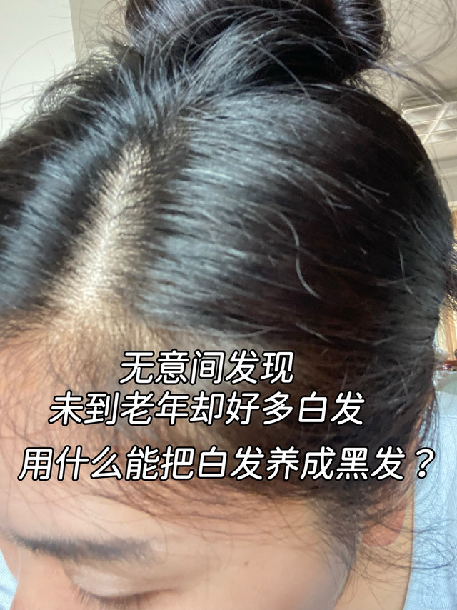 震惊自己白发越来越多，不推销不广告，只蹲真实有效养黑经验