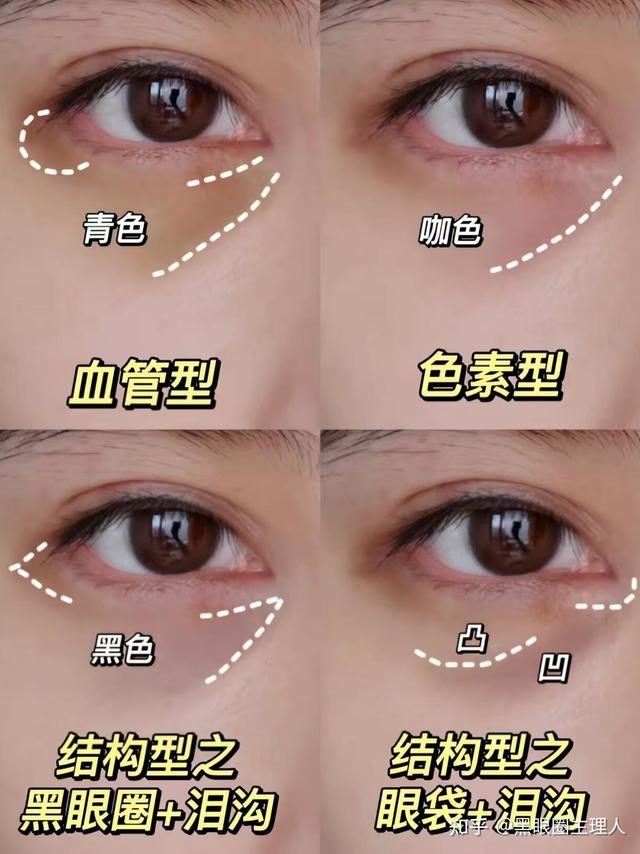 淡化黑眼圈眼膜618选购指南！熬夜党公认好用的眼膜推荐CA冻干眼膜眼膜