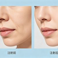 水光针到底值不值得打？不同品牌怎么选？我把功课整理出来了