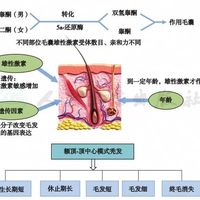 中国首款外用抗雄脱发新药III期成功，男女通用有望年内上市