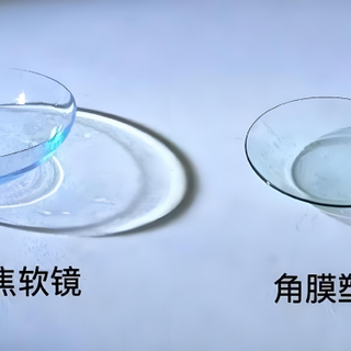 离焦软镜VS OK镜：谁更适合孩子控近视？