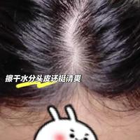 白醋洗头真能让白发变黑？三类偏方效果与风险全解析