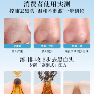 ilso黑头导出液Hello Kitty联名 无酸温和溶解黑白头清洁毛孔粉刺