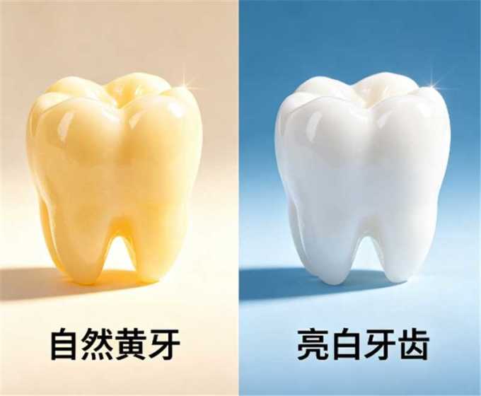 洁牙用具