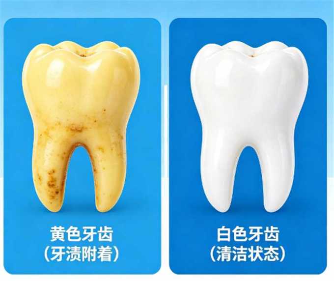 洁牙用具