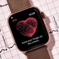 Apple Watch房颤历史功能获批！2000人临床验证，精准度亮了