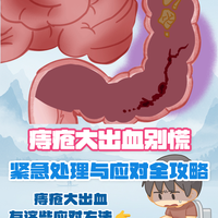 突发状况不慌张：痔疮出血的紧急处理与长期养护