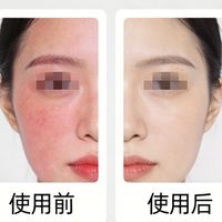 敏感肌洗脸巾选错=每天“磨皮”！平纹珍珠纹到底怎么选？