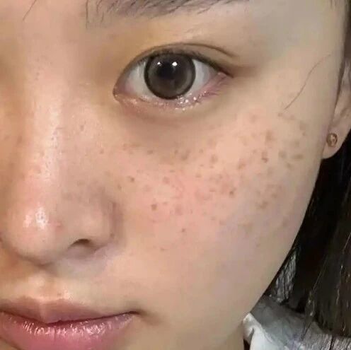 祛斑美白的护肤品什么牌子？30天坚持露卡菲娅祛斑套装｜淡斑提亮褪黄气，告别色斑焦虑